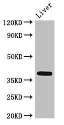 Polyclonal Rabbit anti-Human TEL-2 / ETV7 Antibody (aa134-218, IHC, WB)