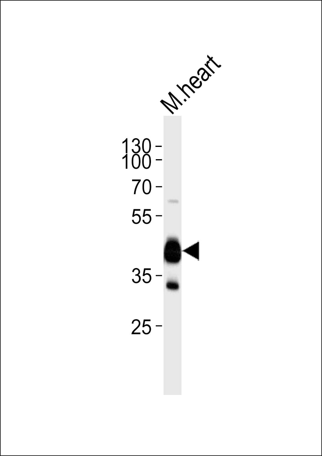 LDB3 / ZASP Antibody (aa101-134)