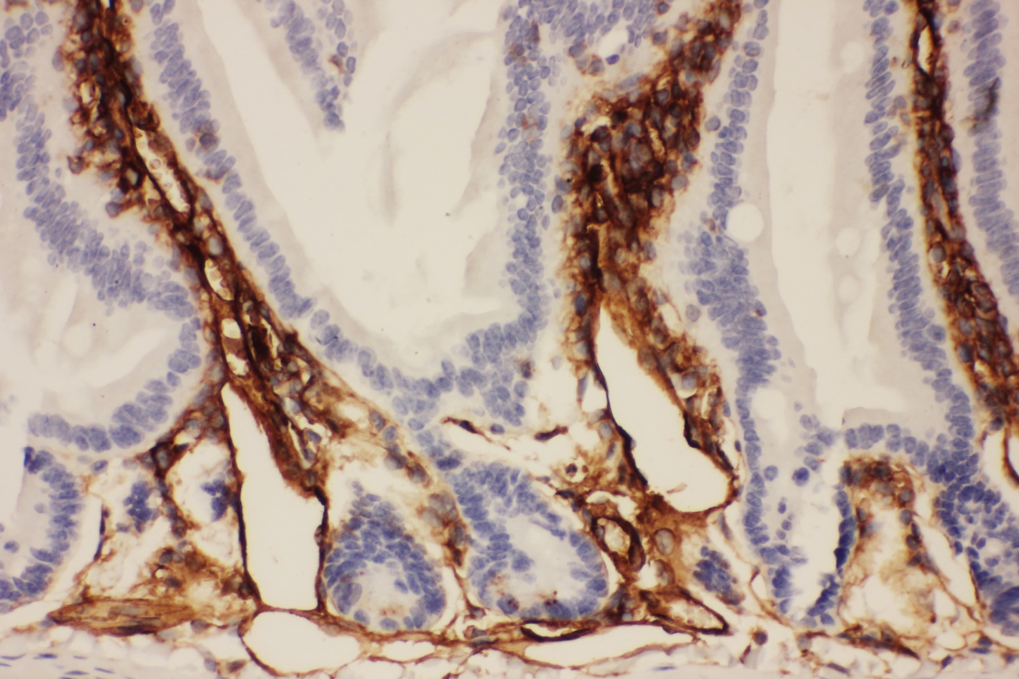 ICAM-1 / CD54 Antibody (aa198-537)