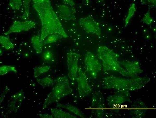 Monoclonal Mouse anti-Human Osteocalcin Antibody (clone 2D4, IF, WB)
