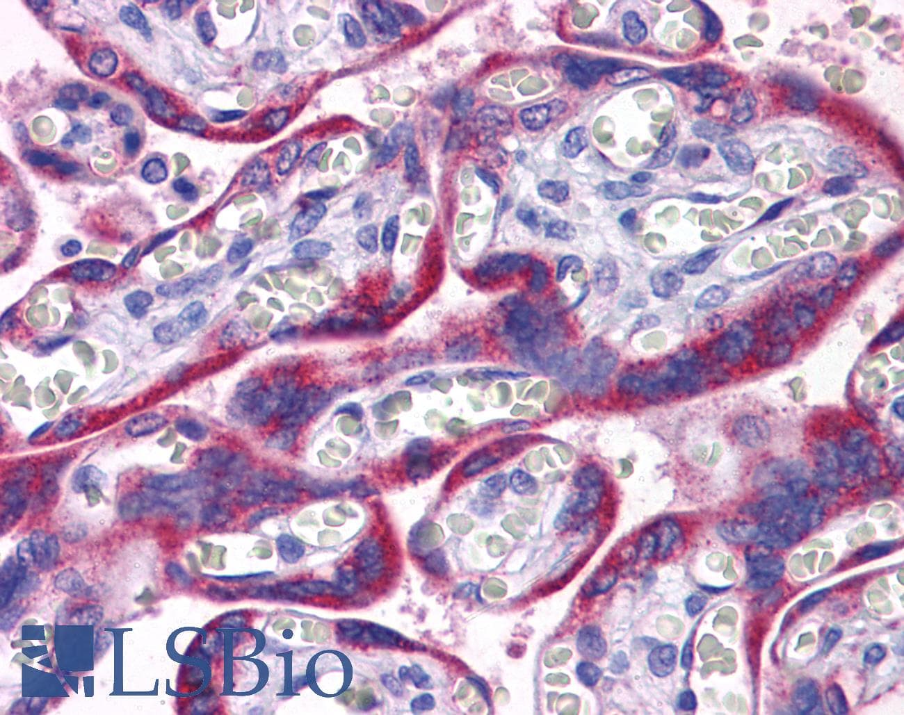 IHC-plus™ PAPPA2 / Pappalysin 2 Antibody
