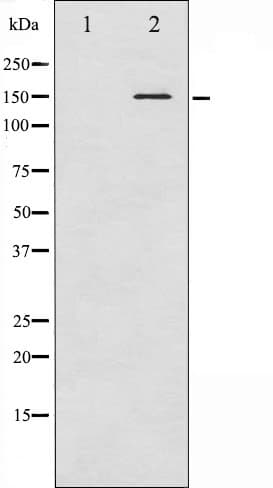 CML / BCR Antibody (phospho-Tyr360)