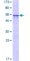 Human SARNP / Hcc-1 / CIP29 Protein (Recombinant GST)