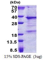 Human THAP3 Protein (Recombinant His)
