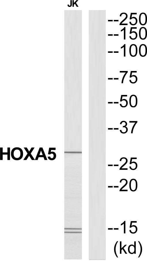 Polyclonal Rabbit anti-Human HOXA5 Antibody (WB)