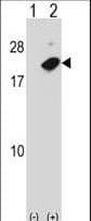 NUDT2 Antibody (aa62-90)