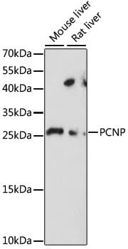 Polyclonal Rabbit anti-Human PCNP Antibody (WB)