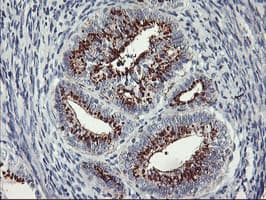 GOLM1 / GP73 / GOLPH2 Antibody (clone OTI3D7)