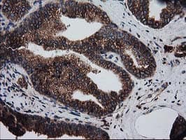 ERGIC-53 / LMAN1 Antibody (clone OTI1E3)