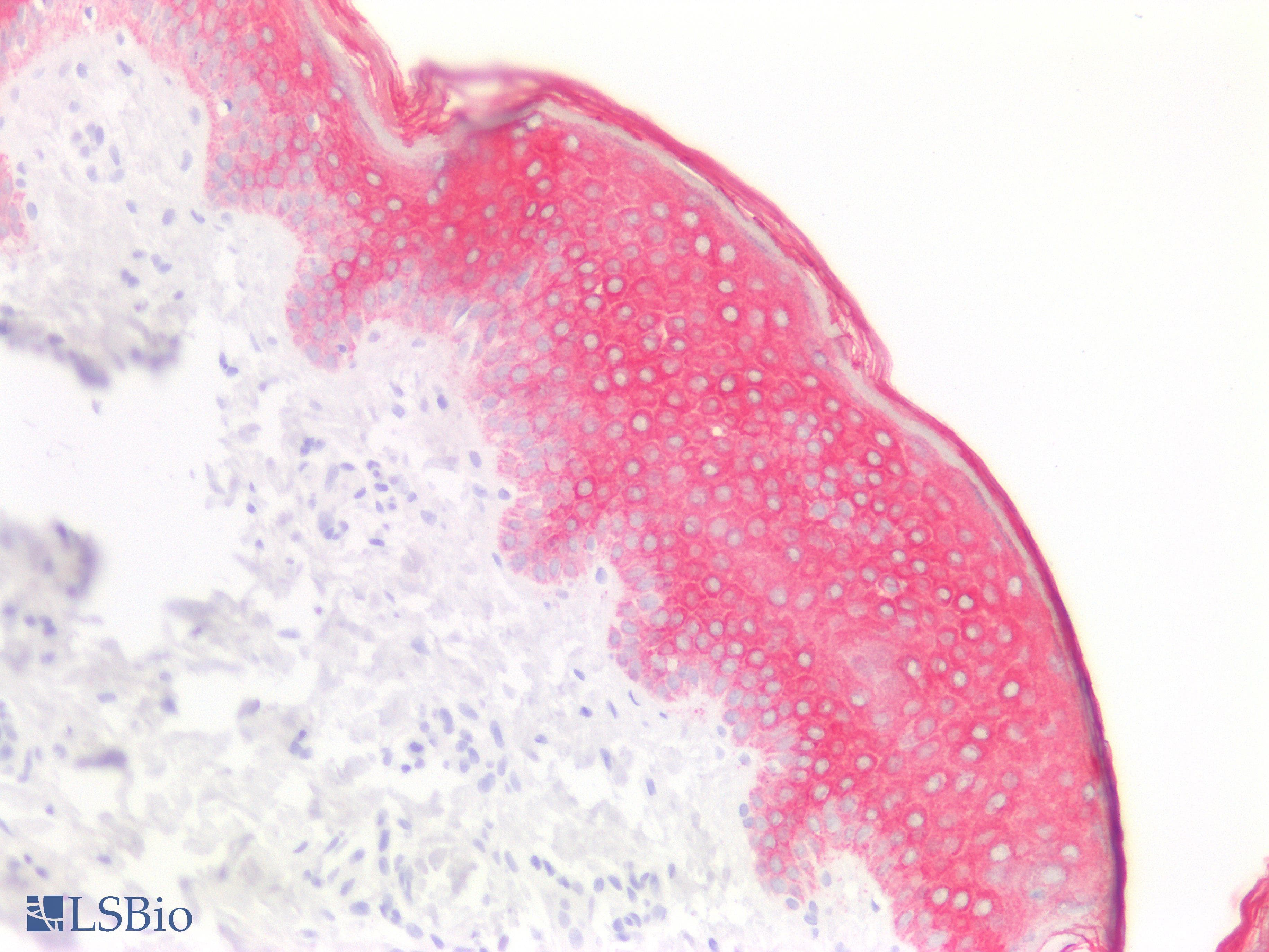 PathPlus™ KRT10 / CK10 / Cytokeratin 10 Antibody (clone PT0071)