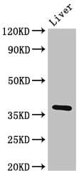 PPP1CB Antibody