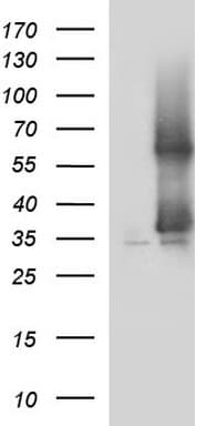 Monoclonal Mouse anti-Human SCAMP2 Antibody (clone OTI1H10, IHC, WB)