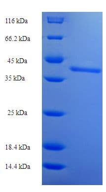 Human SSX2 Protein (Recombinant His-SUMO)