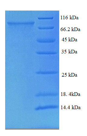 Human TCHP Protein (Recombinant His-SUMO)