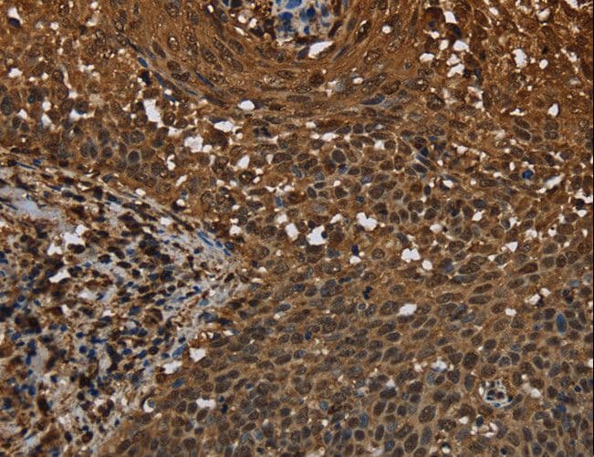 Polyclonal Rabbit anti-Human MYBBP1A Antibody (IHC)