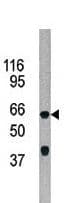 Polyclonal Rabbit anti-Human ADCK5 Antibody (aa434-464, IHC, WB)