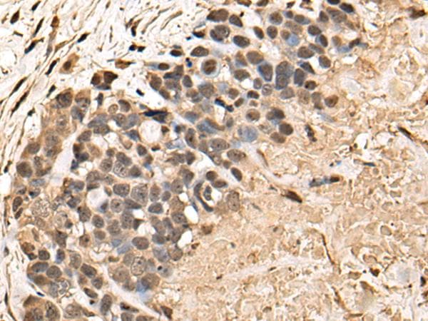 BUD31 Antibody