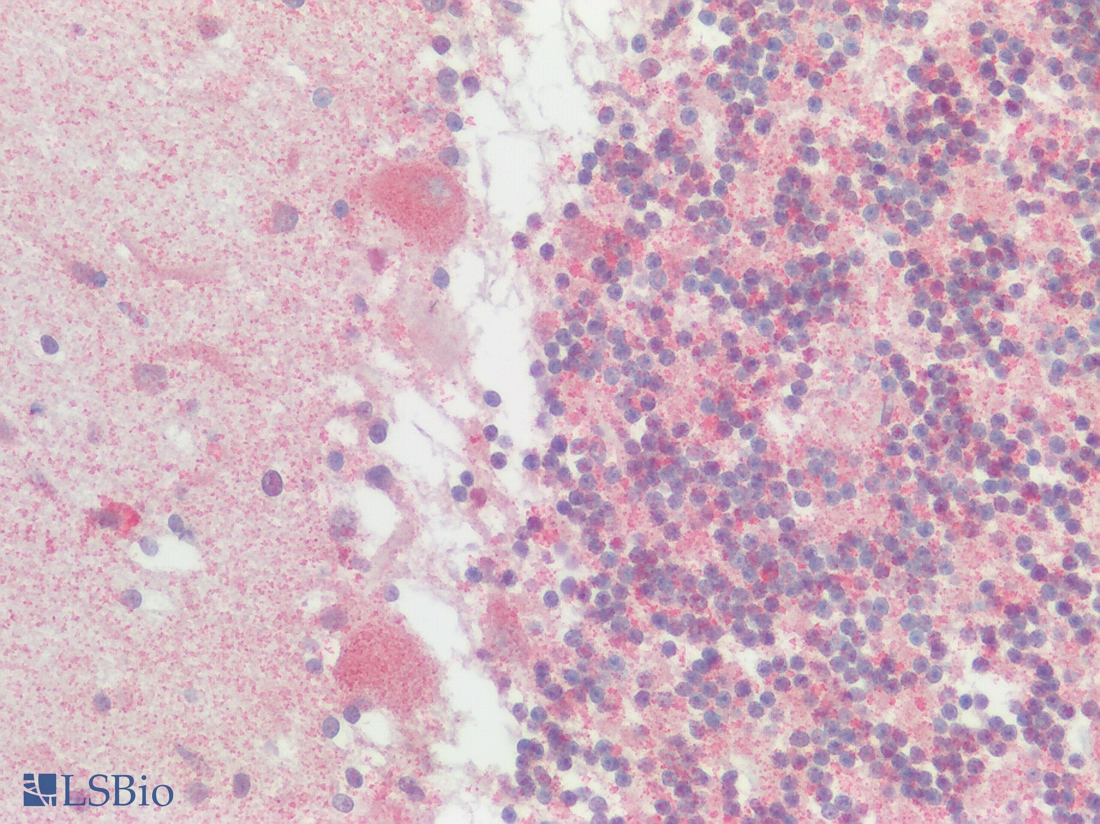 IHC-plus™ SSTR2 Antibody (Extracellular Domain)
