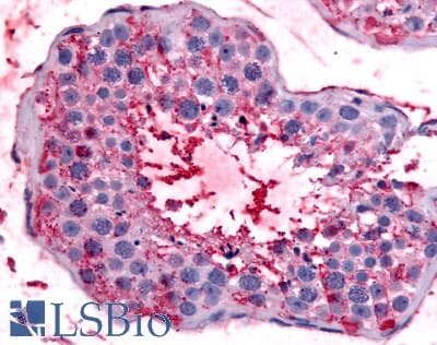IHC-plus™ Polyclonal Rabbit anti-Human BEST2 / Bestrophin-2 Antibody (Internal, IHC)