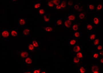 VPS72 Antibody