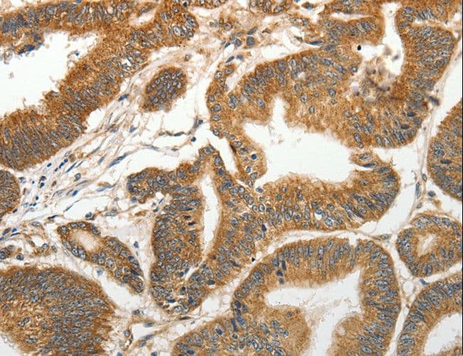 Polyclonal Rabbit anti-Human SLC4A4 / NBC1 Antibody (IHC)