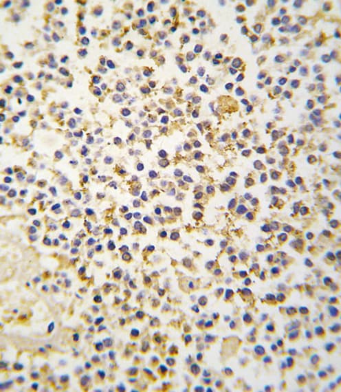 Polyclonal Rabbit anti-Human ALDH1A3 Antibody (aa24-51, IHC, WB)