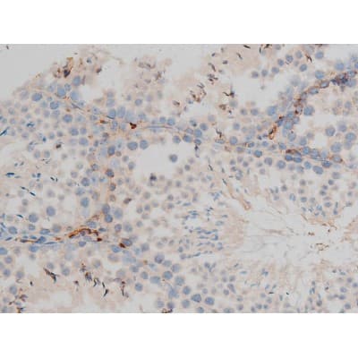 CREB1 / CREB Antibody (phospho-Ser142)