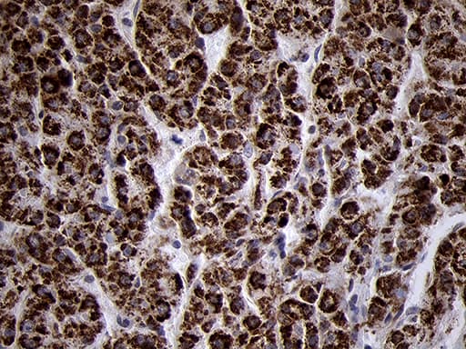 TIMM8A Antibody (clone OTI5C8)