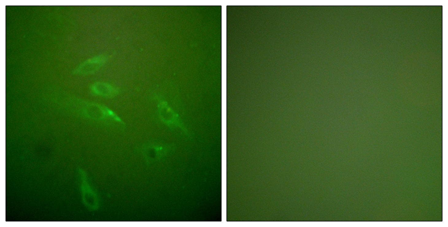 Collagen III Antibody