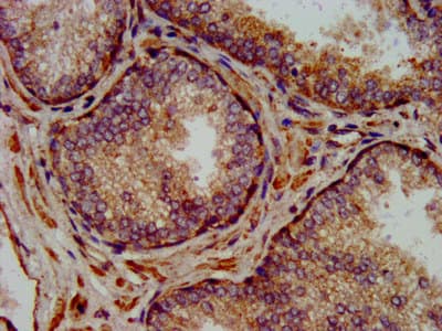 Polyclonal Rabbit anti-Human NLRP7 / NALP7 Antibody (IHC)