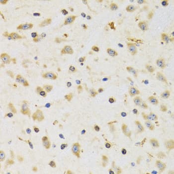 Polyclonal Rabbit anti-Human RPS12 / Ribosomal Protein S12 Antibody (IHC, IF, WB)