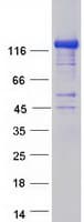 Human CADPS2 Protein (Recombinant Myc-DDK (Flag))