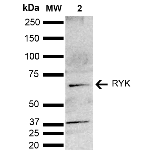 RYK Antibody (Biotin)