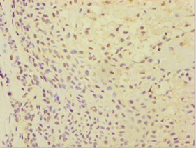 Polyclonal Rabbit anti-Human ATP5J Antibody (aa1-108, IHC)