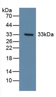 NEP / DDR1 Antibody (aa568-829)