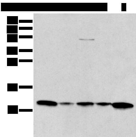 Polyclonal Rabbit anti-Human I-309 / CCL1 Antibody (WB)