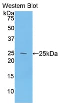 DSC1 / Desmocollin 1 Antibody (aa486-686)