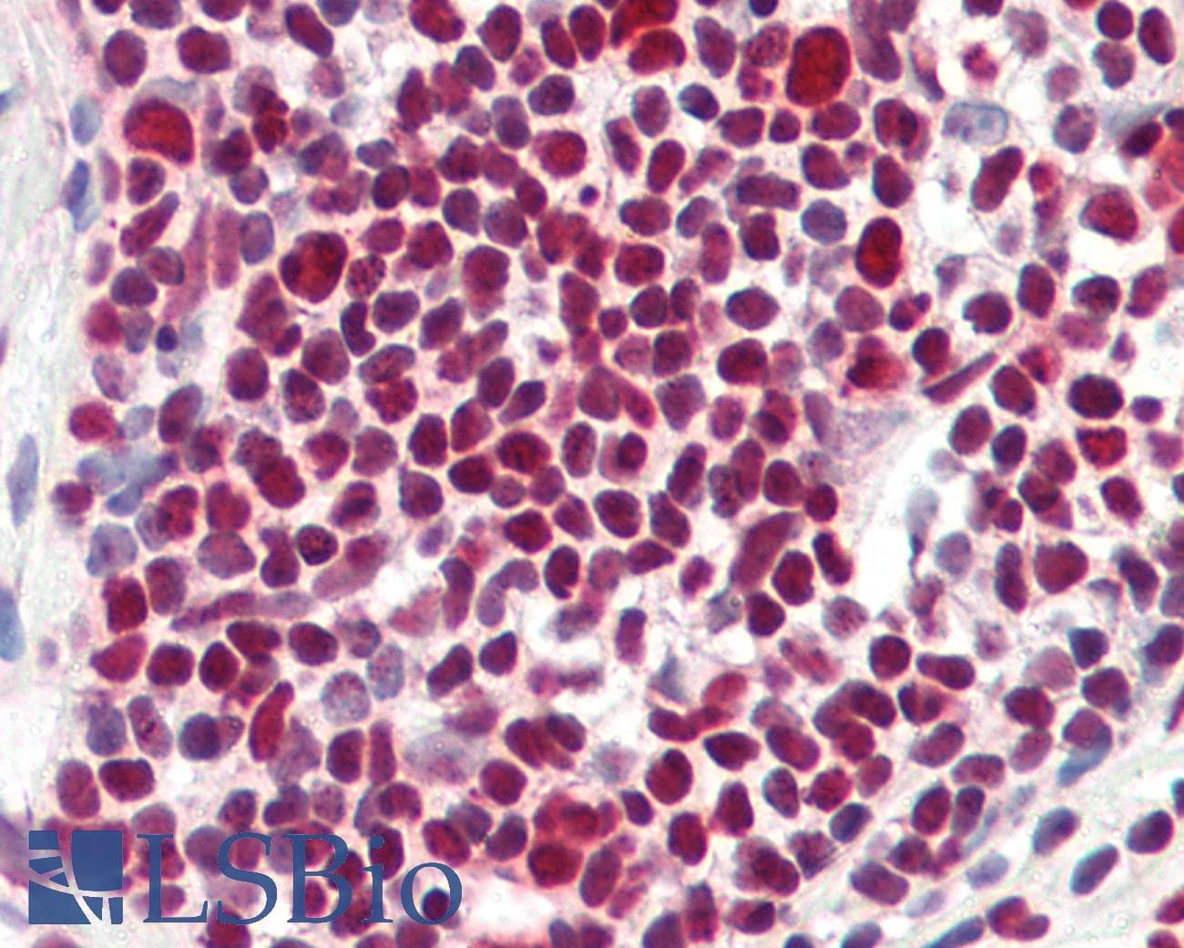 IHC-plus™ Polyclonal Rabbit anti-Human HDAC1 Antibody (aa433-482, IHC, IF, WB)