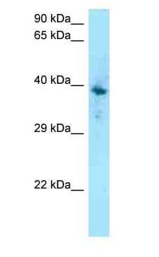 F2RL1 / PAR2 Antibody (C-Terminus)