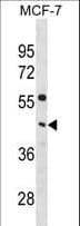 PCYT1A / CCT Alpha Antibody (aa281-309)