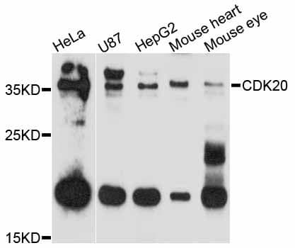 CDK20 / CCRK Antibody