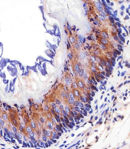 Monoclonal Mouse anti-Human EGFR Antibody (aa1163-1191, IHC, WB)