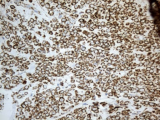 MCAD / ACADM Antibody (clone OTI10A5, Carrier-free)