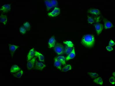 SEMA5B / Semaphorin 5B Antibody