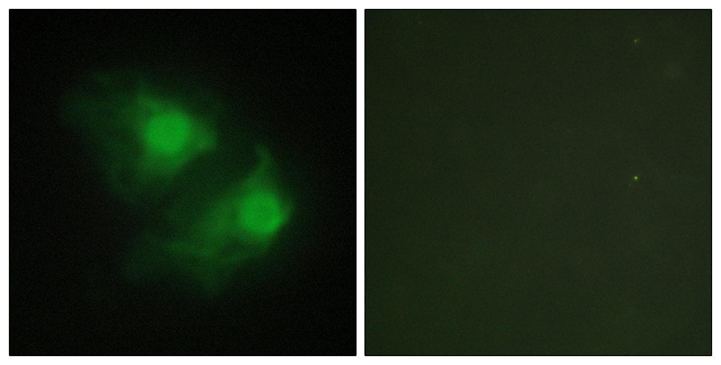 Polyclonal Rabbit anti-Human LIMK2 Antibody (IHC, IF, WB)