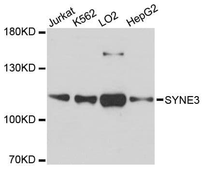 Polyclonal Rabbit anti-Human SYNE3 / C14orf49 Antibody (WB)