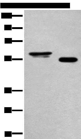 Polyclonal Rabbit anti-Human HAS3 Antibody (WB)