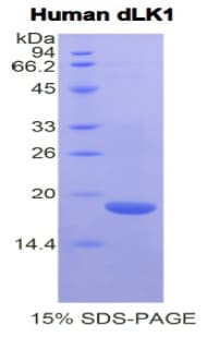 Human DLK1 / Pref-1 Protein (Recombinant His)