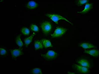 Polyclonal Rabbit anti-Human SDHAF2 Antibody (IHC, IF)