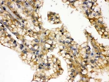 Polyclonal Rabbit anti-Human AQP2 / Aquaporin 2 Antibody (IHC, WB)